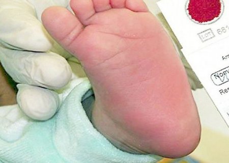 ‘Junho Lilás’: Secretaria de Saúde apoia realização do Teste do Pezinho em recém-nascidos