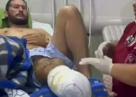 Após perder perna em acidente, policial luta para comprar prótese