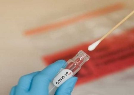 Covid-19 em MS: Estado registra 7 novas mortes pela doença