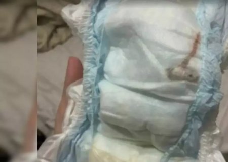 Mãe encontra rato morto na fralda de bebê de um mês