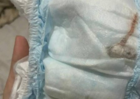 “Rato” encontrado em fralda de bebê era um pedaço de plástico