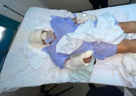 Mulher de 45 anos sobrevive a ataque brutal com facão enquanto dormia no Paraguai