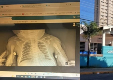 Bebê sai de maternidade com clavícula quebrada e família relata negligência