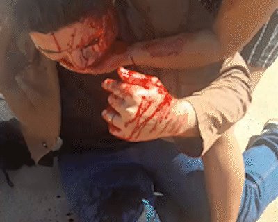 TRÊS LAGOAS: Jornalista aparece ensanguentado e diz que foi agredido por perseguição política