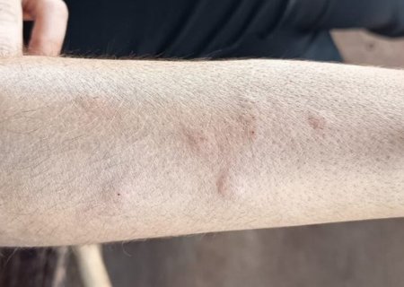 ANGÉLICA: MPMS investiga possível relação entre usina de açúcar e álcool e infestação de moscas