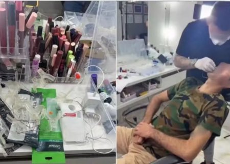 Falso dentista é preso ao ser flagrado colocando facetas em dentes de cliente dentro de salão de beleza em MS